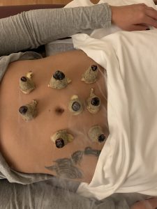 Moxibustion For Infertility and Digestion